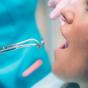 Endodonti Nedir?